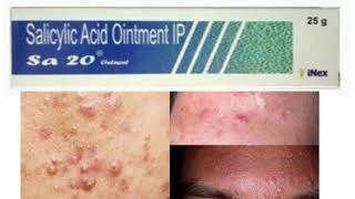 Sa 20 Ointment salicylic acid ointment [upl. by Irol]