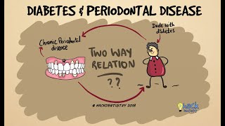 Diabetes and periodontitis The two way relationship [upl. by Vil]