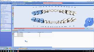 Formation traitements DentAdmin [upl. by Juxon]