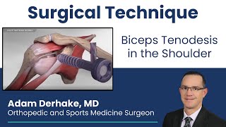 Biceps Tenodesis in the Shoulder Surgical Technique [upl. by Akselav]