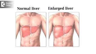 How long will it take for an inflamed liver to heal  Dr Nanda Rajaneesh [upl. by Imak623]