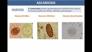 Infecciones por nemátodos intestinales [upl. by Aurea]