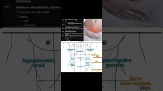 R10 Douleur abdominale et pelvienne [upl. by Swec]