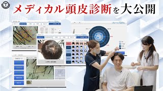 【薄毛治療の第一歩】 メディカル頭皮診断を大公開！ [upl. by Nicolea]