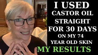 I USED CASTOR OIL FOR 30 DAYS ON MY 74YEAROLD SKIN  MY RESULTS [upl. by Marashio]