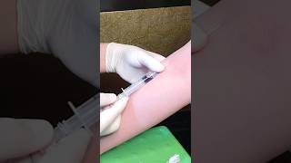 How to Take Venous Blood Sample  Venipuncture [upl. by Neeluj]