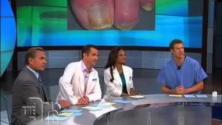 The Doctors on Laser Toenail Fungus Removal [upl. by Elocan]