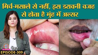 Mouth Ulcer यानी मुंह में छाले क्यों हो जाते हैं कैसे ठीक करें जानें Doctors से  Sehat ep 309 [upl. by Eelarak]