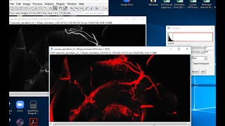 Using ImageJ FIJI to visualize confocal microscopy image stack video tutorial [upl. by Beverie]