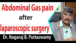 Abdominal Gas pain after laparoscopic surgery  Dr Nagaraj B Puttaswamy [upl. by Laubin]