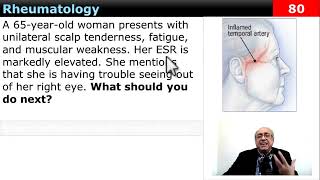 internalmedicine cme usmle محاضراتباطنة ecg كورساتباطنة clinical clinical medicine [upl. by Krik103]