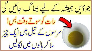 Magical Home Remedies To Get Rid Of Head Lice  Juain Khatam Karne Ka Tarika [upl. by Coshow]