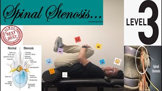 Major Exercises of Lumbar Spinal StenosisBack PainNumbnessTingling  Level 3 [upl. by Humphrey504]