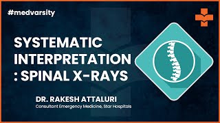 Systematic Interpretation of Spinal XRays  Medical Case Discussion [upl. by Brant]