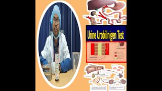 Urine Urobilinogen test in Bangla Urobilinogen in urine test Urobilinogen test procedure [upl. by Oeak12]