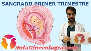 SANGRADO PRIMER TRIMESTRE Diagnóstico diferencial causas ecografía  Ginecología y Obstetricia [upl. by Aillicec68]