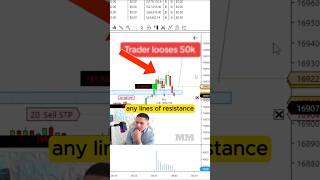 He made a big loss daytrading [upl. by Atinal]