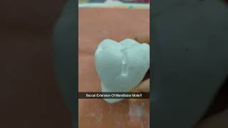 Buccal Extension Of Mandibular Molar ytshorts shorts dentistry Happysmiles16 [upl. by Tenaj331]