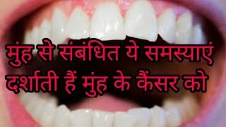 muh ke cancer ke lakshanमुँह के कैंसर के लक्षणmouth cancer symptoms [upl. by Lyn180]