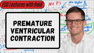 Premature Ventricular Contractions  Day 3 ECG Challenge [upl. by Kuska]