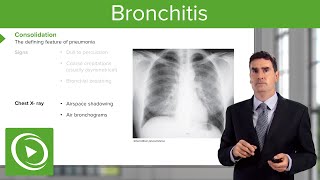 Pneumonia Introduction amp Types – Respiratory Medicine  Lecturio [upl. by Margarete]