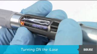 BIOLASE iLase Diode Laser Setup and Operation [upl. by Laeria]