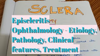 Episcleritis  Sclera  Ophthalmology third year mbbs [upl. by Arremat]