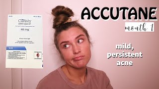 MY ACCUTANE EXPERIENCE  mild persistent acne  month 1 [upl. by Meir]