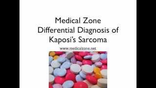 Medical Zone  Differential Diagnosis of Kaposis Sarcoma [upl. by Dearman]