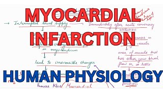 Myocardial Infarction Subendomyocardial Infarction CVS Human Physiology [upl. by Harv]