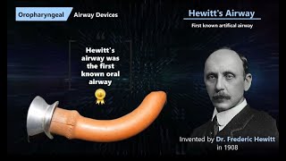 History of Airway Devices [upl. by Ettereve545]