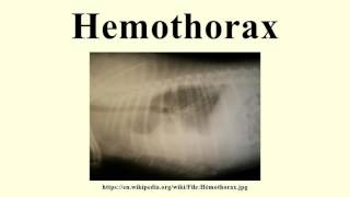 Hemothorax [upl. by Winikka]