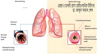 homoeohospital lerningforeveryoneএজমা [upl. by Mitran]