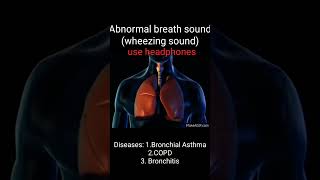 Wheezingabnormal breath soundAsthmaCOPDBronchitisHow to different wheezing soundMed school way [upl. by Neilla]