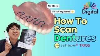 Digital Highlight  How To Properly Scan Full Dentures with 3Shape TRIOS [upl. by Assillam139]