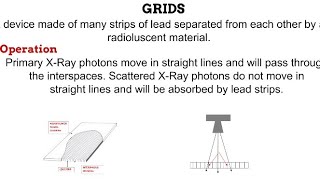 7 Control of Scattered Radiation2 RADIOGRAPHIC EQUIPMENT [upl. by Arimahs]