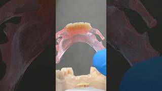 TCS FiberFlex Partial tcsdentalinc tcsdentalinc dental teeth smile lsk121shorts shortvideo [upl. by Anitsej497]