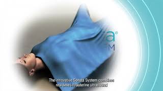 Sonata Fibroid Treatment Procedure Animation [upl. by Aeki845]