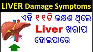 Liver ଖରାପ ହେବାର ୧୧ ଟି ଲକ୍ଷଣ  Liver problem Odia  Liver damage symptoms in Odia  ODIA HEALTH TIPS [upl. by Noevart213]