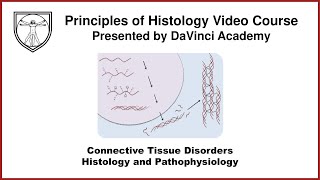 Connective Tissue Disorders Histology and Pathophysiology Connective Tissue Histology Part 3 of 3 [upl. by Ylime]