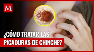 ¿Te picó una chinche Te decimos cómo tratar la picadura en casa [upl. by Ytsim468]