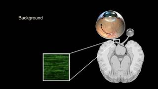 Use of Echo Acoustic Liquid Handling in Functional Genomic Screening of Retinal Ganglion Cells [upl. by Welcy]