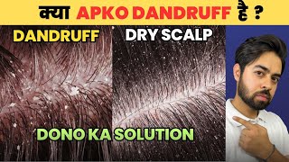 Say Goodbye to Dandruff or Dry Scalp HONEST SOLUTIONS [upl. by Brookhouse]