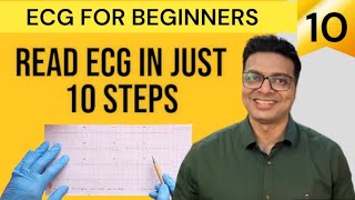 ECG for Beginners  10 Easy steps of reading an ECG  Normal ECG  Writing the findings of the ECG [upl. by Hax]