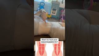 Want to Heal your Diastasisrecti diastasisrecti youtubeshorts postpartum abworkout core [upl. by Aeneg]