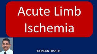 Acute Limb Ischemia [upl. by Leanor751]