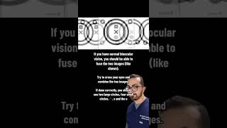 This Binocular Vision Test checks for your ability to cross your eyes and fuse the seperate images s [upl. by Eittam822]