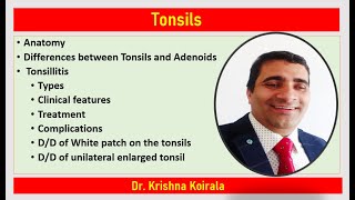 Tonsils  Anatomy Tonsillitis White patch on the tonsils DD of unilateral enlarged tonsil [upl. by Clementina29]