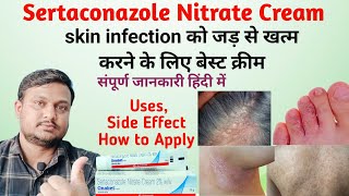 Sertaconazole cream  sertaconazole nitrate cream 2 ww  Onabet cream  sertaconazole [upl. by Anad]