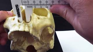 Measuring Nasal Index [upl. by Joktan288]